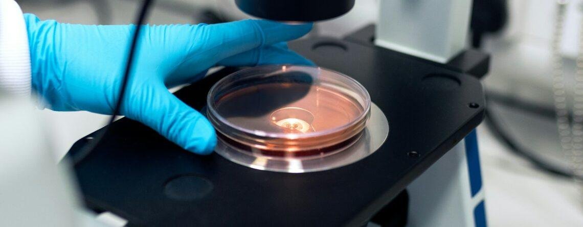 Gloved hand placing a petri dish under a laboratory microscope